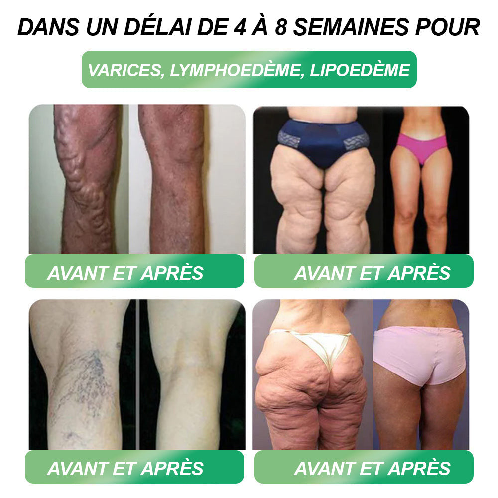 Boutique officielle | 𝙃𝐻𝑉𝖡®🌿🌿𝐺𝐿𝑃-𝟏 SIX IN-ONE Solution de santé liquide oral (Juste une dose par jour, changements visibles en 7 jours) ✅ Pour l'obésité, la santé cardiovasculaire, le diabète, l'apnée du sommeil, les problèmes articulaires, et plus encore